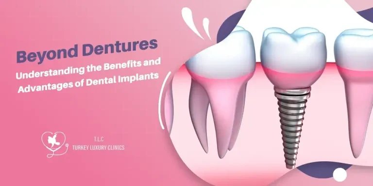 Understanding the Benefits of Dental Implants