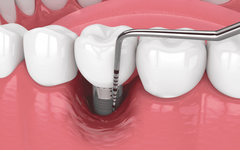 Elevate Your Oral Health with Cutting-Edge Tools